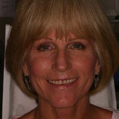 Cosmetic Smile Makeover — before